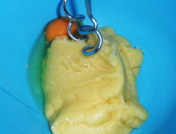 Syrové guľky s cícerovou nátierkou (fotorecept) - obrázok 4