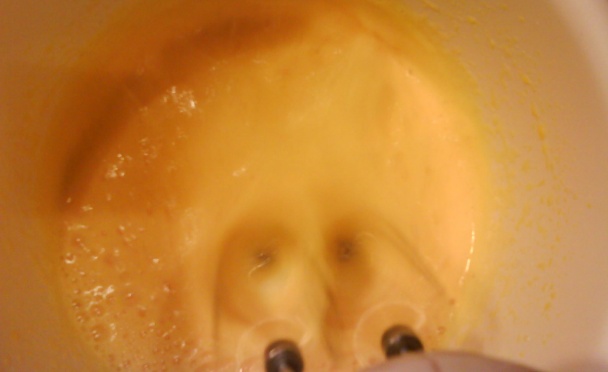 Zhlavové rezy (fotorecept) - obrázok 1